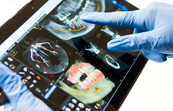 Dentist looking at x-rays and models of teeth on a tablet