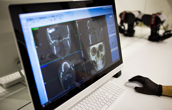 Computer screen showing several images of a patient's jaws