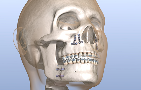 Illustration of the skull and jaws