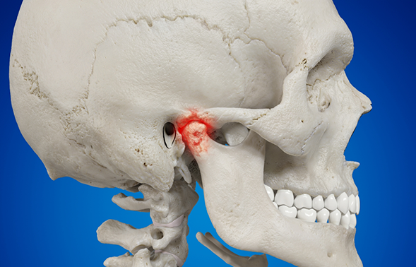 Illustration of a skull with the jaw joint highlighted in red