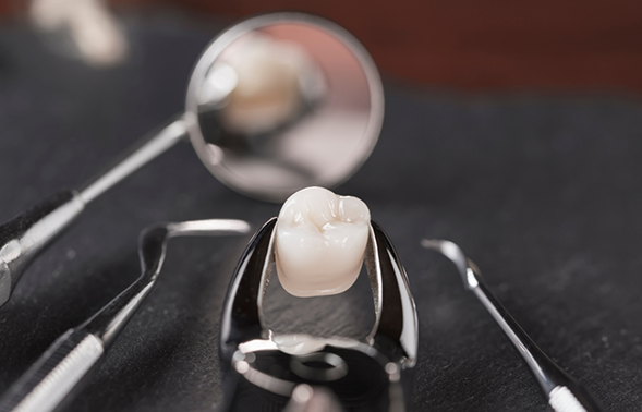 Tweezers holding an extracted tooth