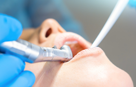 Close up of a dental patient having a tooth removed